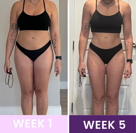 Post Partum Waist Trainer