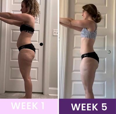 Post Partum Waist Trainer